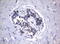 Fc Fragment Of IgG Receptor Ia antibody, LS-C796742, Lifespan Biosciences, Immunohistochemistry paraffin image 