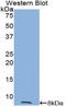 Trefoil Factor 3 antibody, LS-C296802, Lifespan Biosciences, Western Blot image 