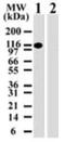 DNA Methyltransferase 3 Alpha antibody, GTX13887, GeneTex, Western Blot image 