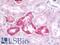 RNA Polymerase III Subunit E antibody, LS-C119920, Lifespan Biosciences, Immunohistochemistry paraffin image 
