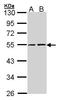 RuvB Like AAA ATPase 2 antibody, LS-B4213, Lifespan Biosciences, Western Blot image 