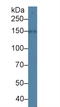 Solute Carrier Family 12 Member 3 antibody, LS-C300213, Lifespan Biosciences, Western Blot image 