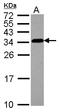 Tubulin Folding Cofactor B antibody, LS-C155518, Lifespan Biosciences, Western Blot image 