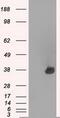 Aurora Kinase C antibody, GTX84838, GeneTex, Western Blot image 