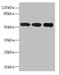 Inosine Monophosphate Dehydrogenase 2 antibody, A59478-100, Epigentek, Western Blot image 