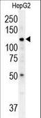 ATPase 13A3 antibody, LS-C156640, Lifespan Biosciences, Western Blot image 