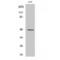 Cholecystokinin B Receptor antibody, LS-C382508, Lifespan Biosciences, Western Blot image 