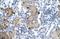 Zinc Finger MYM-Type Containing 6 antibody, A13352, Boster Biological Technology, Immunohistochemistry paraffin image 
