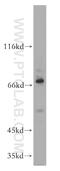 Zinc finger protein PLAGL2 antibody, 11540-1-AP, Proteintech Group, Western Blot image 