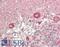 EPH Receptor A6 antibody, LS-B14564, Lifespan Biosciences, Immunohistochemistry paraffin image 