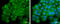 AT antibody, GTX117370, GeneTex, Immunocytochemistry image 