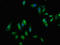 EPH Receptor B3 antibody, LS-C670118, Lifespan Biosciences, Immunofluorescence image 