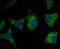 Ryanodine Receptor 2 antibody, NBP2-76961, Novus Biologicals, Immunocytochemistry image 