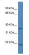 Cathepsin K antibody, NBP1-79878, Novus Biologicals, Western Blot image 