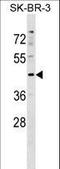 Serine/Threonine Kinase 24 antibody, LS-C158267, Lifespan Biosciences, Western Blot image 