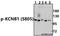 Potassium Voltage-Gated Channel Subfamily B Member 1 antibody, A02108S805, Boster Biological Technology, Western Blot image 
