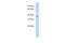 Transmembrane Protein 82 antibody, PA5-69337, Invitrogen Antibodies, Western Blot image 