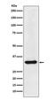 Heterogeneous Nuclear Ribonucleoprotein A1 antibody, M01476, Boster Biological Technology, Western Blot image 