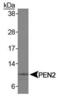 Presenilin Enhancer, Gamma-Secretase Subunit antibody, PA3-16762, Invitrogen Antibodies, Western Blot image 