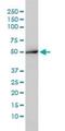 Aminoacylase 1 antibody, H00000095-M01, Novus Biologicals, Western Blot image 