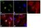 RuvB Like AAA ATPase 1 antibody, PA5-29278, Invitrogen Antibodies, Immunofluorescence image 