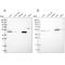 Phosphate Cytidylyltransferase 2, Ethanolamine antibody, NBP1-83952, Novus Biologicals, Western Blot image 