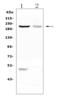 Kinesin Family Member 20B antibody, A08340, Boster Biological Technology, Western Blot image 