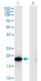 Heat Shock Protein Family B (Small) Member 6 antibody, H00126393-M03, Novus Biologicals, Western Blot image 