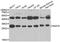N(Alpha)-Acetyltransferase 10, NatA Catalytic Subunit antibody, A02890, Boster Biological Technology, Western Blot image 