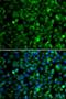 Trimethyllysine Hydroxylase, Epsilon antibody, LS-C346354, Lifespan Biosciences, Immunofluorescence image 