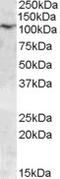 Transient Receptor Potential Cation Channel Subfamily C Member 6 antibody, EB08831, Everest Biotech, Western Blot image 