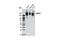 Solute Carrier Family 12 Member 2 antibody, 8351S, Cell Signaling Technology, Western Blot image 
