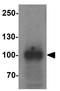 PHD Finger Protein 14 antibody, GTX32120, GeneTex, Western Blot image 