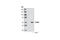 Forkhead Box D3 antibody, 2019S, Cell Signaling Technology, Western Blot image 