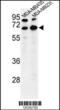 Bestrophin 2 antibody, 63-854, ProSci, Western Blot image 