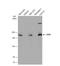 Zinc Finger E-Box Binding Homeobox 1 antibody, NBP2-20942, Novus Biologicals, Western Blot image 