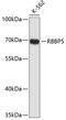 RB Binding Protein 5, Histone Lysine Methyltransferase Complex Subunit antibody, 19-267, ProSci, Western Blot image 