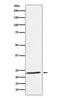 Interleukin 32 antibody, M03286-1, Boster Biological Technology, Western Blot image 