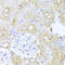 Pyruvate Dehydrogenase Kinase 3 antibody, A05658, Boster Biological Technology, Immunohistochemistry paraffin image 