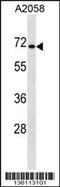 CPEB1 antibody, MBS9213514, MyBioSource, Western Blot image 