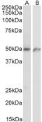 PHD Finger Protein 11 antibody, 43-421, ProSci, Western Blot image 