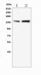 5-Methyltetrahydrofolate-Homocysteine Methyltransferase antibody, A01140-2, Boster Biological Technology, Western Blot image 