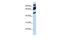 Era Like 12S Mitochondrial RRNA Chaperone 1 antibody, GTX47359, GeneTex, Western Blot image 