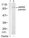 Ribosomal Protein S6 Kinase A1 antibody, PA5-37729, Invitrogen Antibodies, Western Blot image 