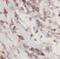 ELAV Like RNA Binding Protein 3 antibody, FNab04072, FineTest, Immunohistochemistry paraffin image 