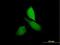 CNKSR Family Member 3 antibody, H00154043-B01P, Novus Biologicals, Immunocytochemistry image 