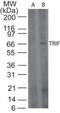 Toll Like Receptor Adaptor Molecule 1 antibody, NB120-13810, Novus Biologicals, Western Blot image 