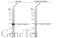 Troponin T2, Cardiac Type antibody, GTX131562, GeneTex, Western Blot image 