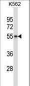 Arginine Vasopressin Receptor 1B antibody, LS-C156695, Lifespan Biosciences, Western Blot image 