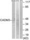 Cell Adhesion Molecule 3 antibody, LS-C119424, Lifespan Biosciences, Western Blot image 